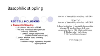Basophilic stippling
 