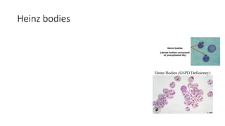 Heinz bodies
 