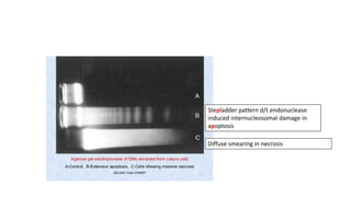 Stepladder pattern d/t endonuclease
induced internucleosomal damage in
apoptosis
Diffuse smearing in necrosis
 