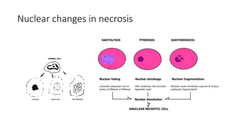 Nuclear changes in necrosis
 