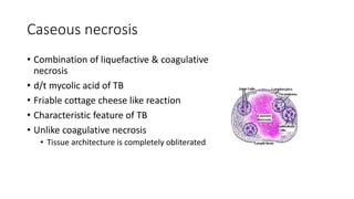 Caseous necrosis
• Combination of liquefactive & coagulative
necrosis
• d/t mycolic acid of TB
• Friable cottage cheese like reaction
• Characteristic feature of TB
• Unlike coagulative necrosis
• Tissue architecture is completely obliterated
 