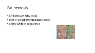 Fat necrosis
• d/t lipases on fatty tissue
• Seen in breast omentum pancreatitis
• Chalky white in appearance
 