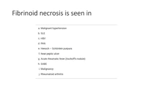Fibrinoid necrosis is seen in
 