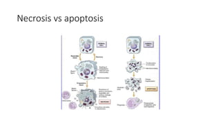 Necrosis vs apoptosis
 