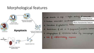 Morphological features
Most characteristic feature
Earliest feature
 