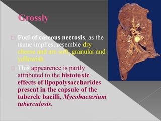 Foci of caseous necrosis, as the
name implies, resemble dry
cheese and are soft, granular and
yellowish.
This appearence is partly
attributed to the histotoxic
effects of lipopolysaccharides
present in the capsule of the
tubercle bacilli, Mycobacterium
tuberculosis.
 