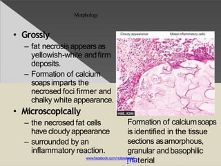 Morphology
• Grossly
– fat necrosis appears as
yellowish-white andfirm
deposits.
– Formation of calcium
soapsimparts the
necrosed foci firmer and
chalky white appearance.
• Microscopically
– the necrosed fat cells
havecloudy appearance
– surrounded by an
inflammatory reaction.
Formation of calciumsoaps
is identified in the tissue
sections asamorphous,
granular andbasophilic
terialwww.facebook.com/notesde
mnta
al
 