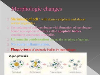 Shrinking of cell : with dense cytoplasm and almost
normal organelles.
Convolution of cell membrane with formation of membrane-
bound near-spherical bodies called apoptotic bodies
containing compacted organelles.
Chromatin condensation around the periphery of nucleus
No acute inflammation.
Phagocytosis of apoptotic bodies by macrophages
 