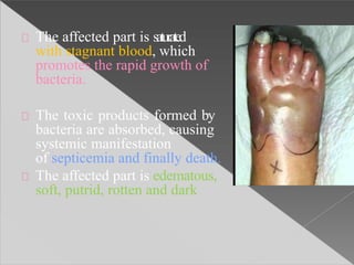 The affected part is saturated
with stagnant blood, which
promotes the rapid growth of
bacteria.
The toxic products formed by
bacteria are absorbed, causing
systemic manifestation
of septicemia and finally death.
The affected part is edematous,
soft, putrid, rotten and dark
 