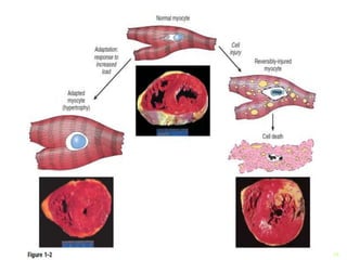 basic Principles of Cell injury | PPT