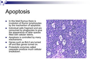 Apoptosis
 In this fetal thymus there is
involution of thymic lymphocytes
by the mechanism of apoptosis.
 Individual cells fragment and are
consumed by phagocytes to give
the appearance of clear spaces
filled with cellular debris.
 Apoptosis is controlled by many
mechanisms.
 Genes such as Bcl-2 are turned
off and Bax genes turned on.
 Proteolytic enzymes called
caspases produce much cellular
breakdown.
 