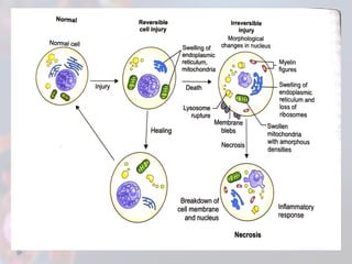 CELL INJURY (Reversible OR Irreversible Cell Injury | PPTX