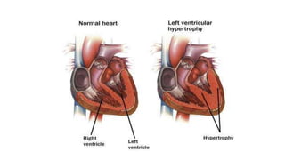 Cell injury death & adaptation