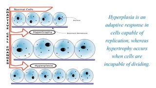 Cell injury death & adaptation