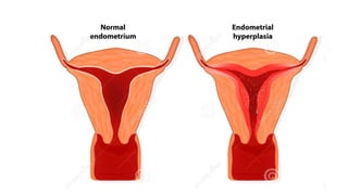 Cell injury death & adaptation