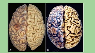 Cell injury death & adaptation