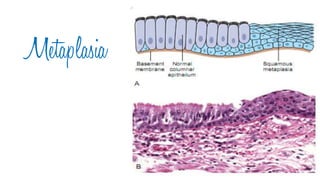 Cell injury death & adaptation