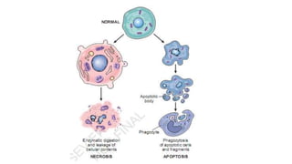 Cell injury death & adaptation