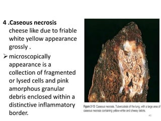 cell injury1.pptx