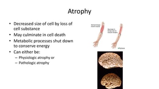 Cell Injury 1a.pdf, metaplasia, hypoxia, | PPT