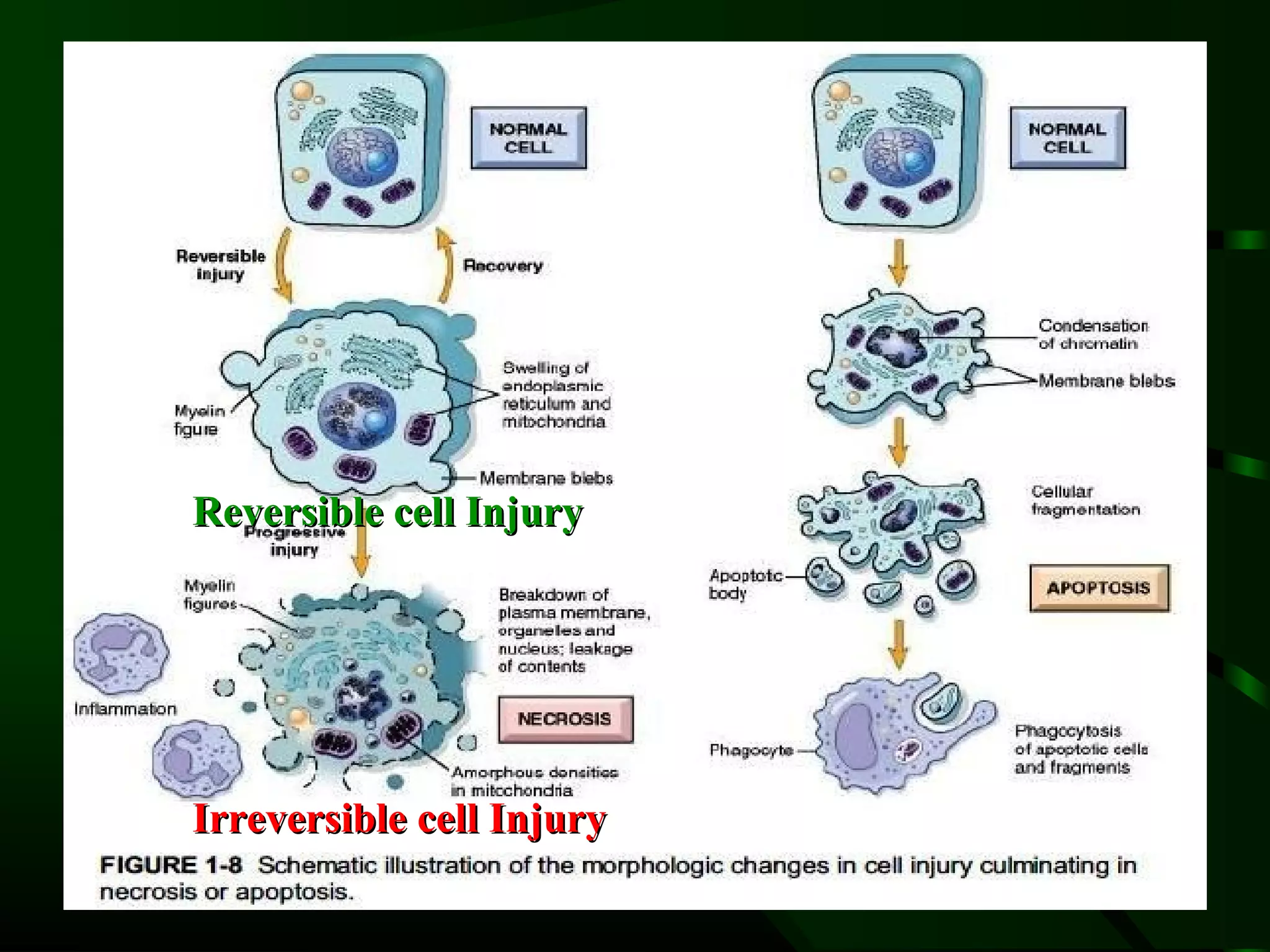 Reversible cell Injury




Irreversible cell Injury
 