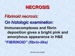 SDUMC-Path-CSBRP
NECROSISNECROSIS
Fibrinoid necrosis:Fibrinoid necrosis:
On histologic examination:On histologic examination:
Immunecomplexes and fibrin
deposition gives a bright pink and
amorphous appearance in H&E
“FIBRINOID” (fibrin-like)
 