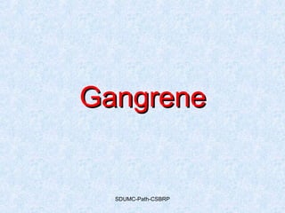 SDUMC-Path-CSBRP
GangreneGangrene
 