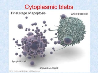 Cytoplasmic blebs
SDUMC-Path-CSBRP
 