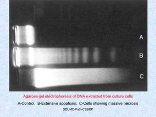 SDUMC-Path-CSBRP
Agarose gel electrophoresis of DNA extracted from culture cells
A-Control, B-Extensive apoptosis, C-Cells showing massive necrosis
 