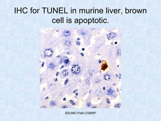 IHC for TUNEL in murine liver, brown
cell is apoptotic.
SDUMC-Path-CSBRP
 