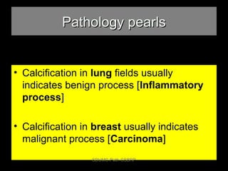 Pathology pearlsPathology pearls
• Calcification in lung fields usually
indicates benign process [Inflammatory
process]
• Calcification in breast usually indicates
malignant process [Carcinoma]
SDUMC-Path-CSBRP
 