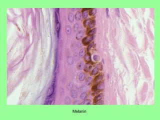 Melanin
 