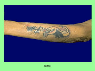 Tattoo
 