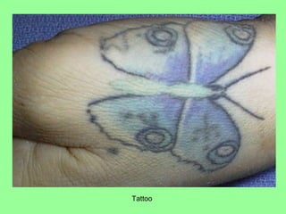 Tattoo
 