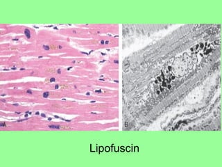 Lipofuscin
 