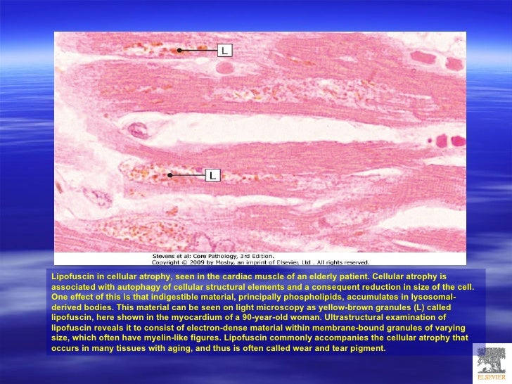 Cell Injury, Adaptation And Accumulations