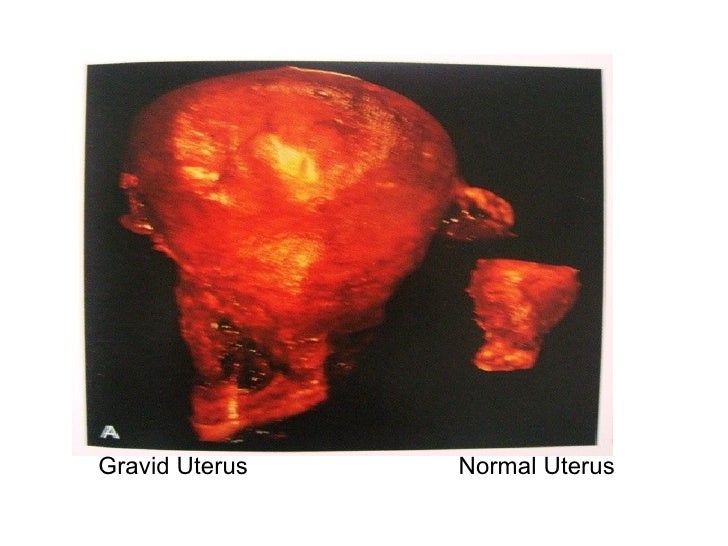 Cell injury, adaptation, and death fix