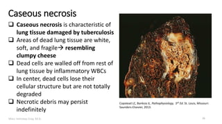 Marc Imhotep Cray, M.D.
Caseous necrosis
Copstead LC, Banksia JL. Pathophysiology, 5th Ed. St. Louis, Missouri:
Saunders-Elsevier, 2013.
26
 Caseous necrosis is characteristic of
lung tissue damaged by tuberculosis
 Areas of dead lung tissue are white,
soft, and fragile resembling
clumpy cheese
 Dead cells are walled off from rest of
lung tissue by inflammatory WBCs
 In center, dead cells lose their
cellular structure but are not totally
degraded
 Necrotic debris may persist
indefinitely
 