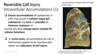 Marc Imhotep Cray, M.D.
Reversible Cell Injury
Intracellular Accumulations (1)
9
Accumulations of silicon dust in tissues
of the lung.
Copstead LC, Banksia JL. Pathophysiology, 5th Ed.
St. Louis, Missouri: Saunders-Elsevier, 2013.
 Excess accumulations of substances in
cells may result in cellular injury b/c
substances are toxic or provoke an
immune response, or
merely b/c they occupy space needed for
cellular functions
 In some cases, accumulations do not in
themselves appear to be injurious but
rather are indicators of cell injury.
 