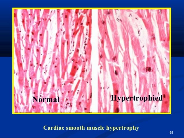 Cell injury and death, med., final 2011