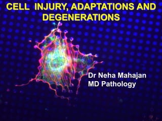 CELL INJURY, ADAPTATIONS AND
DEGENERATIONS
Dr Neha Mahajan
MD Pathology
 