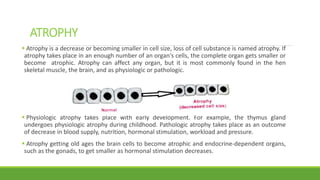 ATROPHY
 Atrophy is a decrease or becoming smaller in cell size, loss of cell substance is named atrophy. If
atrophy takes place in an enough number of an organ's cells, the complete organ gets smaller or
become atrophic. Atrophy can affect any organ, but it is most commonly found in the hen
skeletal muscle, the brain, and as physiologic or pathologic.
 Physiologic atrophy takes place with early development. For example, the thymus gland
undergoes physiologic atrophy during childhood. Pathologic atrophy takes place as an outcome
of decrease in blood supply, nutrition, hormonal stimulation, workload and pressure.
 Atrophy getting old ages the brain cells to become atrophic and endocrine-dependent organs,
such as the gonads, to get smaller as hormonal stimulation decreases.
 