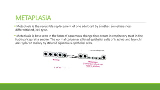 METAPLASIA
 Metaplasia is the reversible replacement of one adult cell by another. sometimes less
differentiated, cell type.
 Metaplasia is best seen in the form of squamous change that occurs in respiratory tract in the
habitual cigarette smoke. The normal columnar ciliated epithelial cells of trachea and bronchi
are replaced mainly by striated squamous epithelial cells.
 