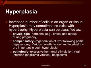 Hyperplasia-
 Increased number of cells in an organ or tissue.
Hyperplasia may sometimes co-exist with
hypertrophy. Hyperplasia can be classified as:
 physiologic--hormonal (e.g., breast and uterus
during pregnancy)
 compensatory--regeneration of liver following partial
hepatectomy. Various growth factors and interluekins
are important in such hyperplasia.
 pathologic--excessive hormonal stimulation, viral
infection (papilloma viruses); neoplasms
Suraj Dhara 13
 