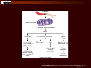 Downloaded from: Robbins & Cotran Pathologic Basis of Disease (on 4 April 2005 06:11 PM)
© 2005 Elsevier
Suraj Dhara 19
 