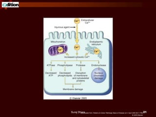 Downloaded from: Robbins & Cotran Pathologic Basis of Disease (on 4 April 2005 06:11 PM)
© 2005 Elsevier
Suraj Dhara 21
 