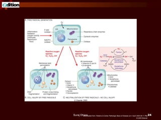 Downloaded from: Robbins & Cotran Pathologic Basis of Disease (on 4 April 2005 06:11 PM)
© 2005 Elsevier
Suraj Dhara 24
 