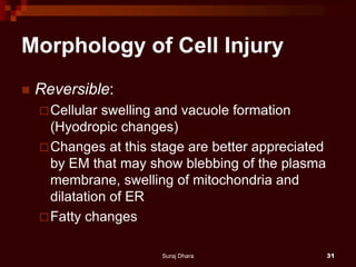 Morphology of Cell Injury
 Reversible:
Cellular swelling and vacuole formation
(Hyodropic changes)
Changes at this stage are better appreciated
by EM that may show blebbing of the plasma
membrane, swelling of mitochondria and
dilatation of ER
Fatty changes
Suraj Dhara 31
 