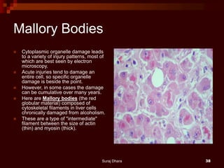 Mallory Bodies
 Cytoplasmic organelle damage leads
to a variety of injury patterns, most of
which are best seen by electron
microscopy.
 Acute injuries tend to damage an
entire cell, so specific organelle
damage is beside the point.
 However, in some cases the damage
can be cumulative over many years.
 Here are Mallory bodies (the red
globular material) composed of
cytoskeletal filaments in liver cells
chronically damaged from alcoholism.
 These are a type of "intermediate"
filament between the size of actin
(thin) and myosin (thick).
Suraj Dhara 38
 