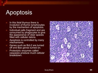 Apoptosis
 In this fetal thymus there is
involution of thymic lymphocytes
by the mechanism of apoptosis.
 Individual cells fragment and are
consumed by phagocytes to give
the appearance of clear spaces
filled with cellular debris.
 Apoptosis is controlled by many
mechanisms.
 Genes such as Bcl-2 are turned
off and Bax genes turned on.
 Proteolytic enzymes called
caspases produce much cellular
breakdown.
Suraj Dhara 65
 